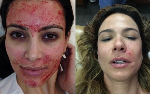 tratamentos de beleza de Kim Kardashian