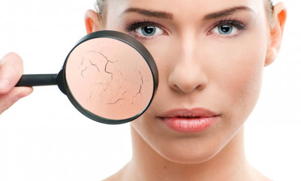 Como evitar ou tratar o ressecamento e vermelhidão no rosto