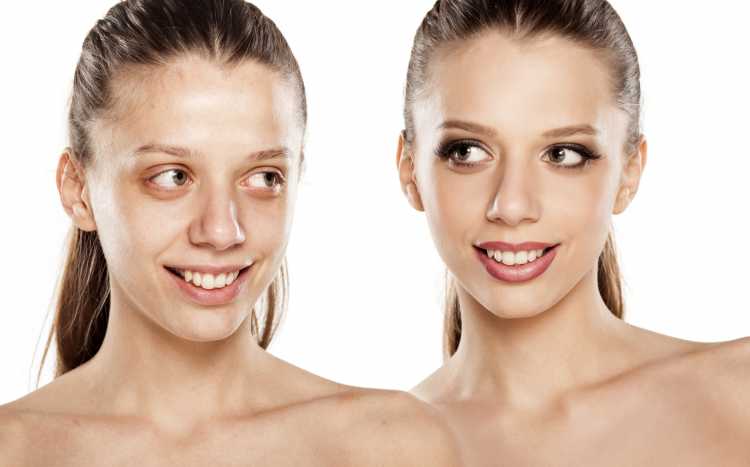 disfarçar manchas no rosto antes e depois